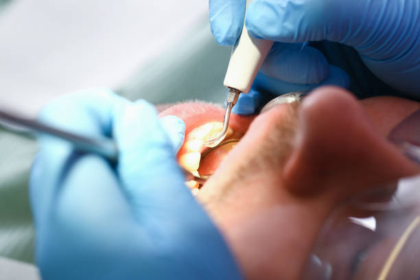 Best Walk-In Emergency Dentist in Edmonston, MD