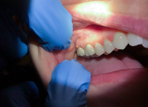 Best Same-Day Emergency Dentist in Edmonston, MD