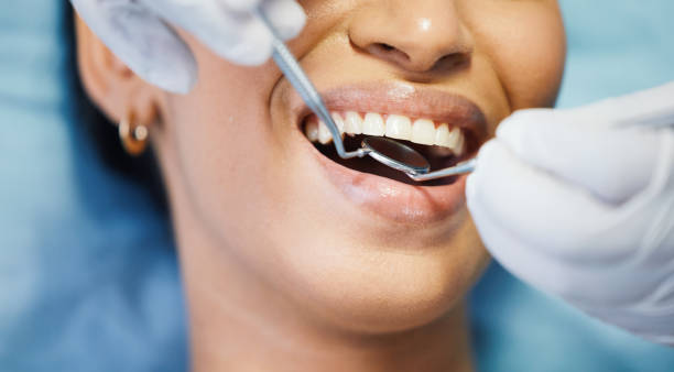 Best After-Hours Emergency Dentist in Edmonston, MD